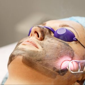 Hollywood Carbon Peel <br><span style="font-size:.75em;color:#c33">50% Discount<br></span><span style="font-weight:500;color:#c33;text-decoration:line-through">£300-£470</span>