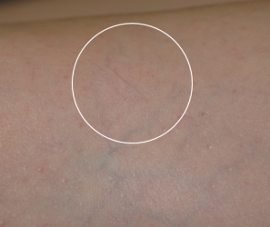 Vascular_B&A_10_after